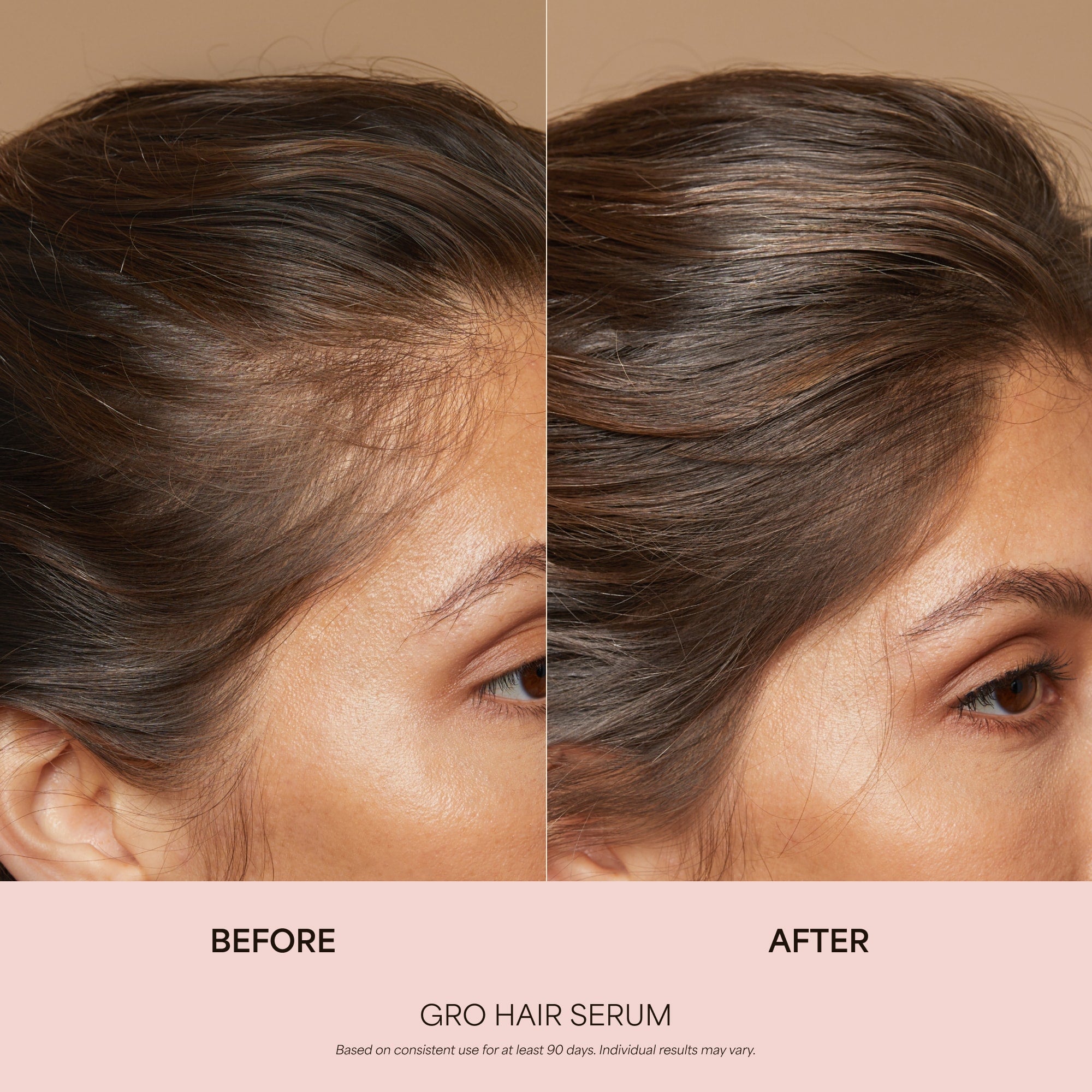 GRO Hair Serum