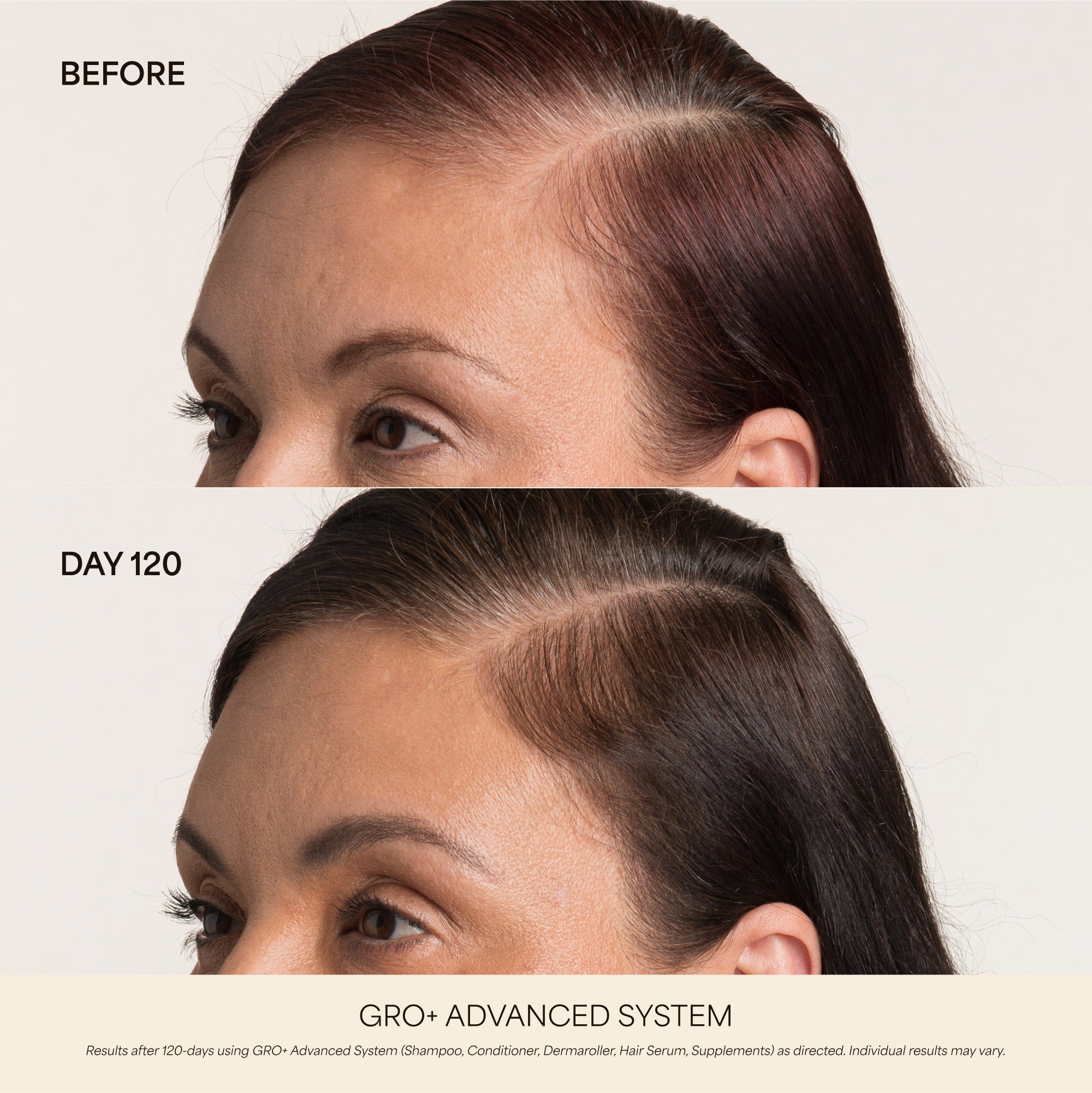 GRO+ Advanced Hair Serum